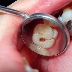 Dental Clinic In Vizag