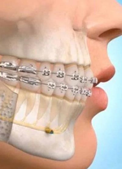 Oral surgery in Bhimavaram